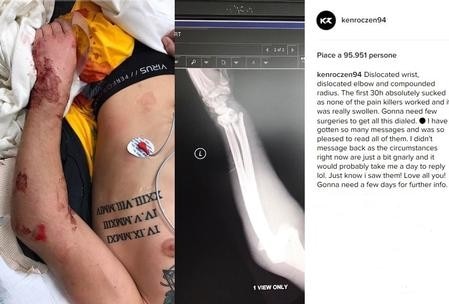 Ken Roczen injury. Gli ultimi aggiornamenti