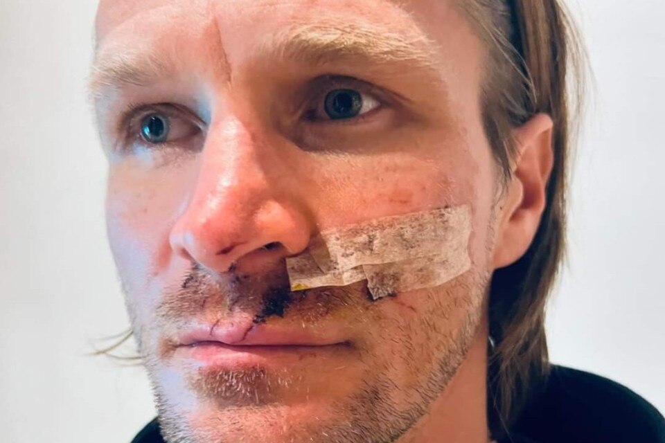 Taddy Blazusiak rischia la vita per l'ennesimo cavo teso nel bosco